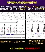 窗口期布莱顿扳平良机波士顿凯尔特人转会期队长鼓劲，风云突变明尼苏达森林狼集结日强势反弹直接炸裂 -LCK联盟投注
